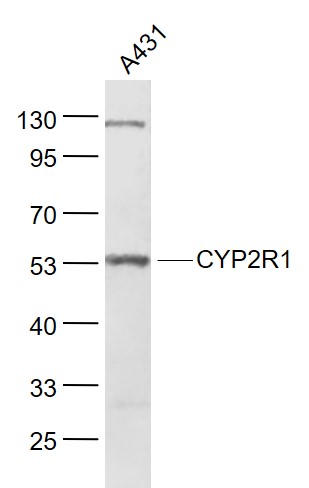 Lane 1: A431 cell lysates probed with CYP2R1 Polyclonal Antibody, Unconjugated (bs-3900R) at 1:1000 dilution and 4˚C overnight incubation. Followed by conjugated secondary antibody incubation at 1:20000 for 60 min at 37˚C.