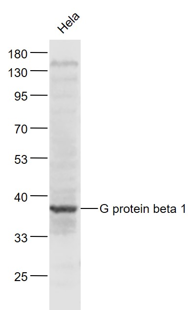Lane 1: Hela cell lysates probed with G protein beta 1/GNB1 Polyclonal Antibody, Unconjugated (bs-3941R) at 1:1000 dilution and 4˚C overnight incubation. Followed by conjugated secondary antibody incubation at 1:20000 for 60 min at 37˚C. Lane 1: Hela cell lysates probed with G protein beta 1/GNB1 Polyclonal Antibody, Unconjugated (bs-3941R) at 1:1000 dilution and 4˚C overnight incubation. Followed by conjugated secondary antibody incubation at 1:20000 for 60 min at 37˚C.