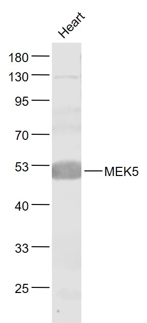 Lane 1: Heart lysates probed with MEK5 Polyclonal Antibody, Unconjugated (bs-4124R) at 1:1000 dilution and 4˚C overnight incubation. Followed by conjugated secondary antibody incubation at 1:20000 for 60 min at 37˚C.