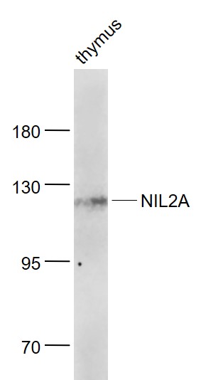 Lane 1: Thymus lysates probed with ZEB Polyclonal Antibody, Unconjugated (bs-4187R) at 1:1000 dilution and 4˚C overnight incubation. Followed by conjugated secondary antibody incubation at 1:20000 for 60 min at 37˚C. Lane 1: Thymus lysates probed with ZEB Polyclonal Antibody, Unconjugated (bs-4187R) at 1:1000 dilution and 4˚C overnight incubation. Followed by conjugated secondary antibody incubation at 1:20000 for 60 min at 37˚C.