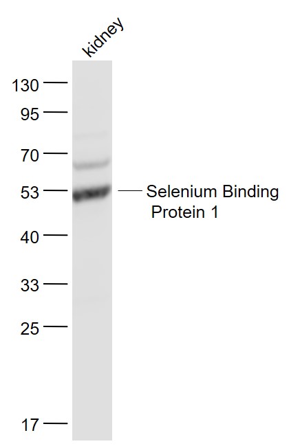 Lane 1: Kindey lysates probed with Selenium Binding Protein 1 Polyclonal Antibody, Unconjugated (bs-4200R) at 1:1000 dilution and 4˚C overnight incubation. Followed by conjugated secondary antibody incubation at 1:20000 for 60 min at 37˚C. Lane 1: Kindey lysates probed with Selenium Binding Protein 1 Polyclonal Antibody, Unconjugated (bs-4200R) at 1:1000 dilution and 4˚C overnight incubation. Followed by conjugated secondary antibody incubation at 1:20000 for 60 min at 37˚C.