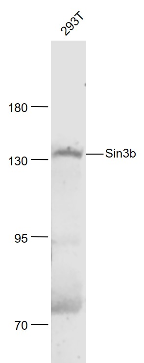 Lane 1: 293T cell lysates probed with Sin3b Polyclonal Antibody, Unconjugated (bs-4215R) at 1:1000 dilution and 4˚C overnight incubation. Followed by conjugated secondary antibody incubation at 1:20000 for 60 min at 37˚C.