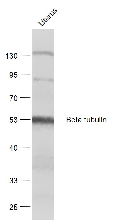 Lane 1: Uterus lysates probed with tubulin Beta Polyclonal Antibody, Unconjugated (bs-4511R) at 1:1000 dilution and 4˚C overnight incubation. Followed by conjugated secondary antibody incubation at 1:20000 for 60 min at 37˚C.