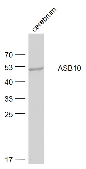 Lane 1: Cerebrum lysates probed with ASB10 Polyclonal Antibody, Unconjugated (bs-4653R) at 1:1000 dilution and 4˚C overnight incubation. Followed by conjugated secondary antibody incubation at 1:20000 for 60 min at 37˚C.