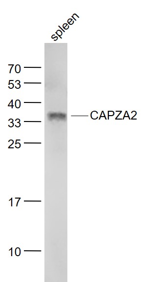 Lane 1: Spleen lysates probed with CAPZA2 Polyclonal Antibody, Unconjugated (bs-5128R) at 1:1000 dilution and 4˚C overnight incubation. Followed by conjugated secondary antibody incubation at 1:20000 for 60 min at 37˚C.
