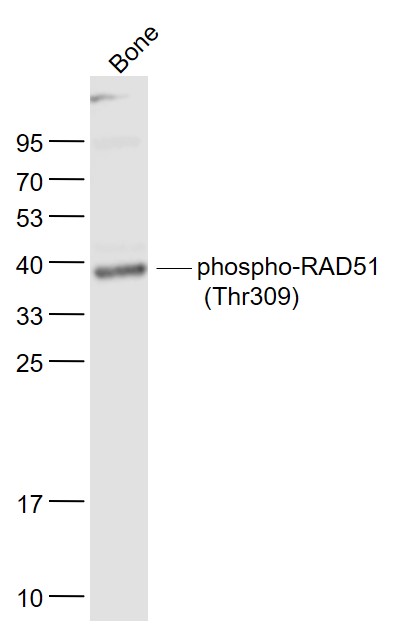 Lane 1: Bone lysates probed with RAD51(Thr309) Polyclonal Antibody, Unconjugated (bs-5677R) at 1:1000 dilution and 4˚C overnight incubation. Followed by conjugated secondary antibody incubation at 1:20000 for 60 min at 37˚C.