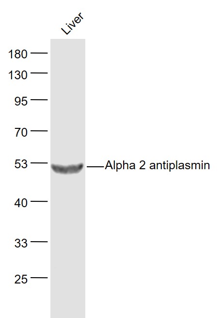 Lane 1: Liver lysates probed with Alpha 2 antiplasmin Polyclonal Antibody, Unconjugated (bs-6188R) at 1:1000 dilution and 4˚C overnight incubation. Followed by conjugated secondary antibody incubation at 1:20000 for 60 min at 37˚C.