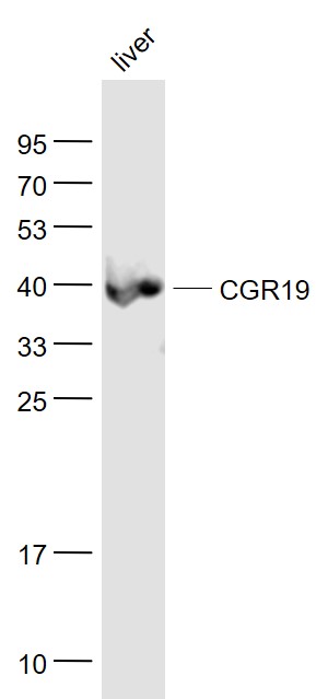 Lane 1: Liver lysates probed with CGR19 Polyclonal Antibody, Unconjugated (bs-6373R) at 1:1000 dilution and 4˚C overnight incubation. Followed by conjugated secondary antibody incubation at 1:20000 for 60 min at 37˚C.
