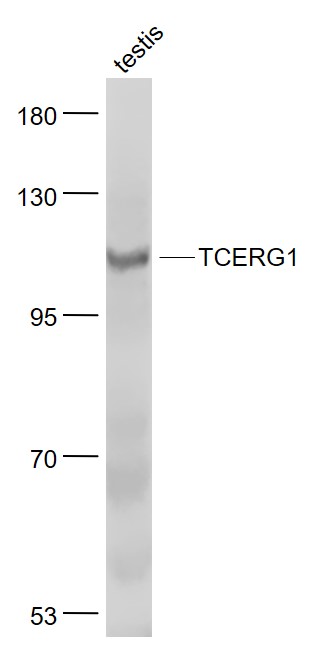 Lane 1: Testis lysates probed with TCERG1 Polyclonal Antibody, Unconjugated (bs-6801R) at 1:1000 dilution and 4˚C overnight incubation. Followed by conjugated secondary antibody incubation at 1:20000 for 60 min at 37˚C.