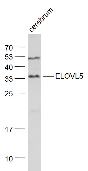 Lane 1: Cerebrum lysates probed with ELOVL5 Polyclonal Antibody, Unconjugated (bs-7054R) at 1:1000 dilution and 4˚C overnight incubation. Followed by conjugated secondary antibody incubation at 1:20000 for 60 min at 37˚C.