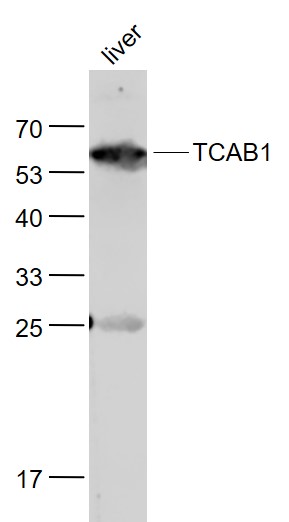 Lane 1: Liver lysates probed with TCAB1 Polyclonal Antibody, Unconjugated (bs-8163R) at 1:1000 dilution and 4˚C overnight incubation. Followed by conjugated secondary antibody incubation at 1:20000 for 60 min at 37˚C.