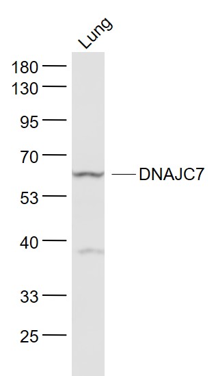 Lane 1: Lung lysates probed with DNAJC7 Polyclonal Antibody, Unconjugated (bs-8280R) at 1:1000 dilution and 4˚C overnight incubation. Followed by conjugated secondary antibody incubation at 1:20000 for 60 min at 37˚C.