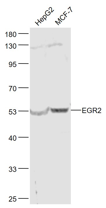 Lane 1: HepG2 cell lysates; Lane 2: MCF-7 cell lysates probed with EGR2 Polyclonal Antibody, Unconjugated (bs-8368R) at 1:1000 dilution and 4˚C overnight incubation. Followed by conjugated secondary antibody incubation at 1:20000 for 60 min at 37˚C.