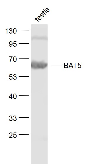 Lane 1: Testis lysates probed with BAT5 Polyclonal Antibody, Unconjugated (bs-9757R) at 1:1000 dilution and 4˚C overnight incubation. Followed by conjugated secondary antibody incubation at 1:20000 for 60 min at 37˚C.