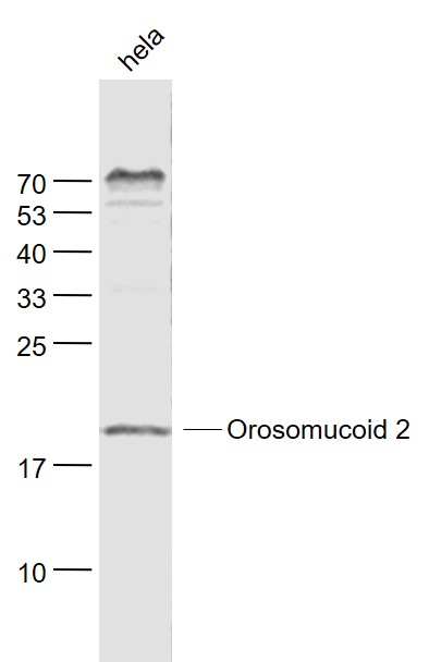 Lane 1: Hela cell lysates probed with Orosomucoid 2 Polyclonal Antibody, Unconjugated (bs-9915R) at 1:1000 dilution and 4˚C overnight incubation. Followed by conjugated secondary antibody incubation at 1:20000 for 60 min at 37˚C.