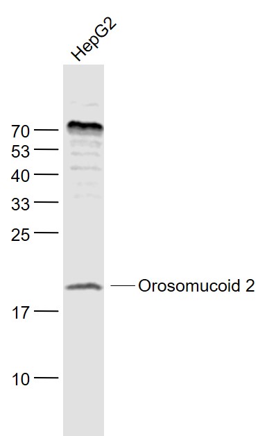 Lane 1: HepG2 cell lysates probed with Orosomucoid 2 Polyclonal Antibody, Unconjugated (bs-9915R) at 1:1000 dilution and 4˚C overnight incubation. Followed by conjugated secondary antibody incubation at 1:20000 for 60 min at 37˚C.