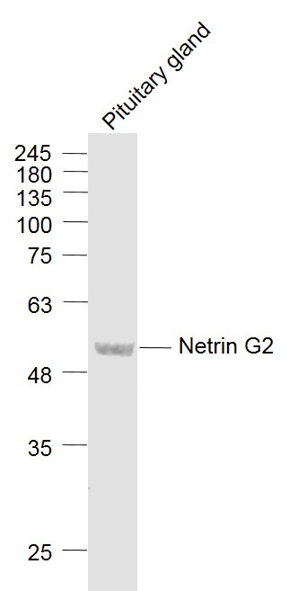 Pituitary gland lysates probed with Netrin G2 Polyclonal Antibody, Unconjugated (bs-11103R) at 1:1000 dilution and 4˚C overnight incubation. Followed by conjugated secondary antibody incubation at 1:20000 for 60 min at 37˚C.