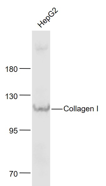 Lane 1: HepG2 cell lysates probed with Collagen 1 Polyclonal Antibody, Unconjugated (bs-10423R) at 1:1000 dilution and 4˚C overnight incubation. Followed by conjugated secondary antibody incubation at 1:20000 for 60 min at 37˚C.