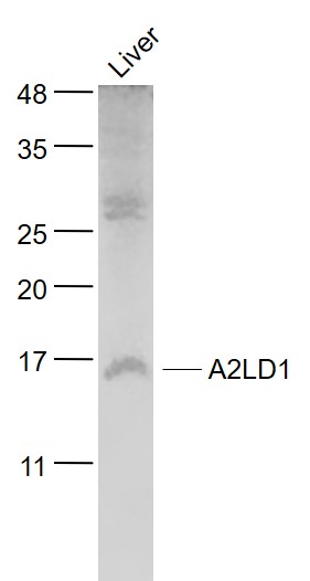 Mouse Liver lysates probed with A2LD1/GGACT Polyclonal Antibody, Unconjugated (bs-11381R) at 1:1000 dilution and 4˚C overnight incubation. Followed by conjugated secondary antibody incubation at 1:20000 for 60 min at 37˚C.