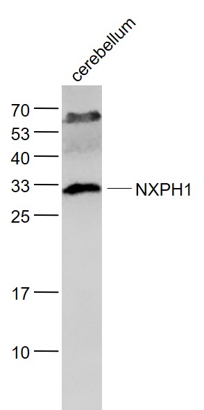 Lane 1: Cerebellum lysates probed with NXPH1 Polyclonal Antibody, Unconjugated (bs-11170R) at 1:1000 dilution and 4˚C overnight incubation. Followed by conjugated secondary antibody incubation at 1:20000 for 60 min at 37˚C.
