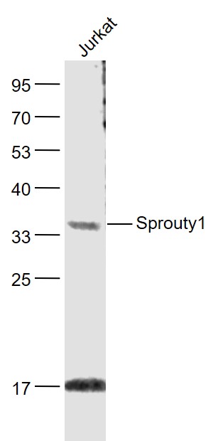 Lane 1: Jurkat cell lysates probed with Sprouty1 Polyclonal Antibody, Unconjugated (bs-11216R) at 1:1000 dilution and 4˚C overnight incubation. Followed by conjugated secondary antibody incubation at 1:20000 for 60 min at 37˚C.