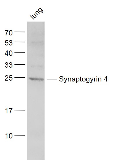 Lane 1: Mouse Lung lysates probed with Synaptogyrin 4 Polyclonal Antibody, Unconjugated (bs-11375R) at 1:1000 dilution and 4˚C overnight incubation. Followed by conjugated secondary antibody incubation at 1:20000 for 60 min at 37˚C.