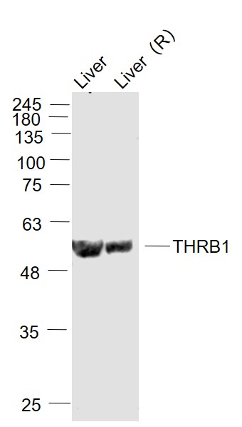 Lane 1: Mouse liver lysates; Lane 2:Rat Liver lysates probed with THRB1 Polyclonal Antibody, Unconjugated (bs-11440R) at 1:1000 dilution and 4˚C overnight incubation. Followed by conjugated secondary antibody incubation at 1:20000 for 60 min at 37˚C. Lane 1: Mouse liver lysates; Lane 2:Rat Liver lysates probed with THRB1 Polyclonal Antibody, Unconjugated (bs-11440R) at 1:1000 dilution and 4˚C overnight incubation. Followed by conjugated secondary antibody incubation at 1:20000 for 60 min at 37˚C.