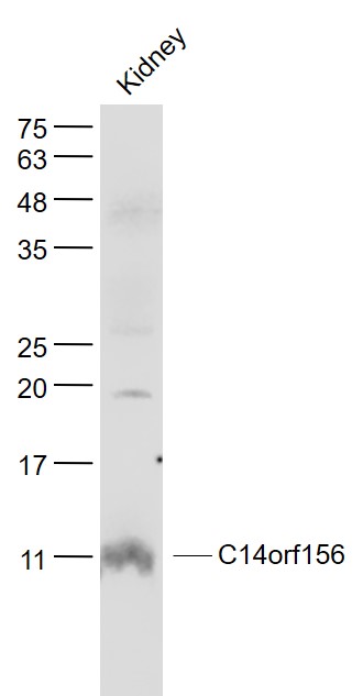 Mouse Kidney lysates probed with SLIRP/C14orf156 Polyclonal Antibody, Unconjugated (bs-21033R) at 1:1000 dilution and 4˚C overnight incubation. Followed by conjugated secondary antibody incubation at 1:20000 for 60 min at 37˚C.