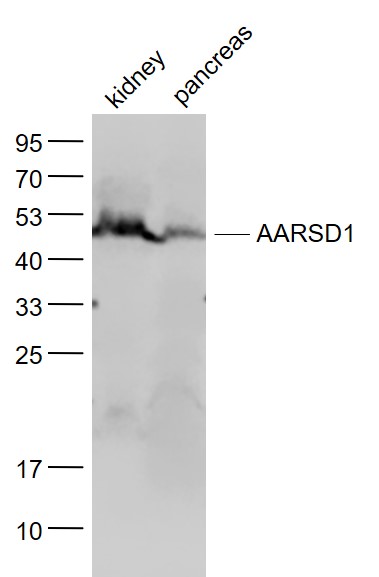Lane 1: Mouse Kindey lysates; Lane 2: Mouse Pancreas lysates probed with AARSD1 Polyclonal Antibody, Unconjugated (bs-11389R) at 1:1000 dilution and 4˚C overnight incubation. Followed by conjugated secondary antibody incubation at 1:20000 for 60 min at 37˚C.