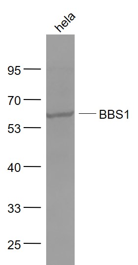 Lane 1: Hela cell lysates probed with BBS1 Polyclonal Antibody, Unconjugated (bs-11507R) at 1:1000 dilution and 4˚C overnight incubation. Followed by conjugated secondary antibody incubation at 1:20000 for 60 min at 37˚C.