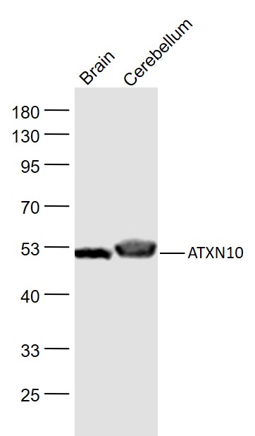 Lane 1: Rat Cerebrum lysates; Lane 2: Mouse Cerebellum lysates probed with ATXN10/SCA10 Polyclonal Antibody, Unconjugated (bs-11806R) at 1:1000 dilution and 4˚C overnight incubation. Followed by conjugated secondary antibody incubation at 1:20000 for 60 min at 37˚C.