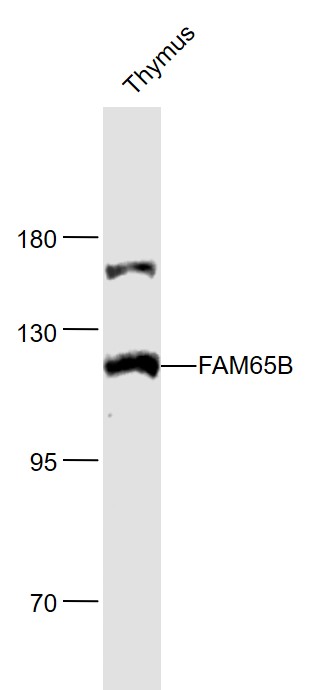 Lane 1: Thymus lysates probed with FAM65B Polyclonal Antibody, Unconjugated (bs-12370R) at 1:1000 dilution and 4˚C overnight incubation. Followed by conjugated secondary antibody incubation at 1:20000 for 60 min at 37˚C. Lane 1: Thymus lysates probed with FAM65B Polyclonal Antibody, Unconjugated (bs-12370R) at 1:1000 dilution and 4˚C overnight incubation. Followed by conjugated secondary antibody incubation at 1:20000 for 60 min at 37˚C.