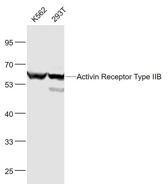 Lane 1:K562 cell lysates; Lane 2: 293T cell lysates probed with ACVR2B/ACTR2B Polyclonal Antibody, Unconjugated (bs-12417R) at 1:1000 dilution and 4˚C overnight incubation. Followed by conjugated secondary antibody incubation at 1:20000 for 60 min at 37˚C.