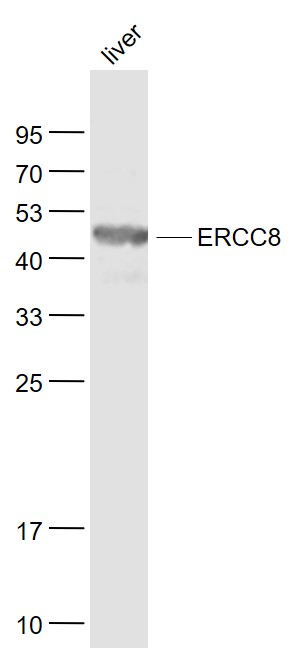 Lane 1: Liver lysates probed with ERCC8/CSA Polyclonal Antibody, Unconjugated (bs-13095R) at 1:1000 dilution and 4˚C overnight incubation. Followed by conjugated secondary antibody incubation at 1:20000 for 60 min at 37˚C.
