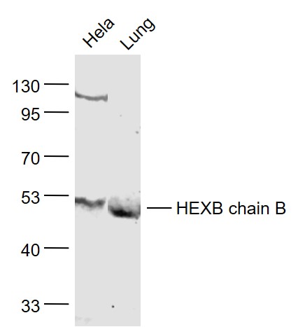 Lane 1: Hela cell lysates; Lane 2: Mouse Lung lysates probed with HEXB Polyclonal Antibody, Unconjugated (bs-15468R) at 1:1000 dilution and 4˚C overnight incubation. Followed by conjugated secondary antibody incubation at 1:20000 for 60 min at 37˚C.