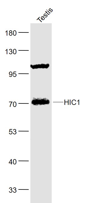 Lane 1: Testis lysates probed with HIC1 Polyclonal Antibody, Unconjugated (bs-15485R) at 1:1000 dilution and 4˚C overnight incubation. Followed by conjugated secondary antibody incubation at 1:20000 for 60 min at 37˚C.