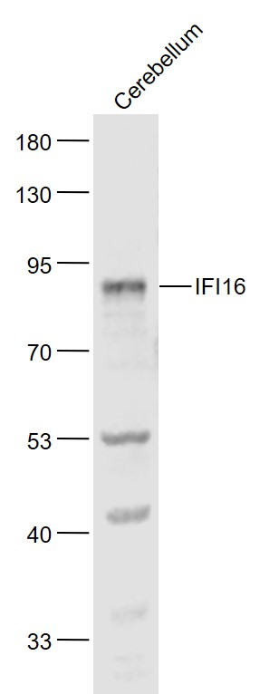 Lane 1: Mouse Cerebellum lysates probed with IFI16 Polyclonal Antibody, Unconjugated (bs-15548R) at 1:1000 dilution and 4˚C overnight incubation. Followed by conjugated secondary antibody incubation at 1:20000 for 60 min at 37˚C.