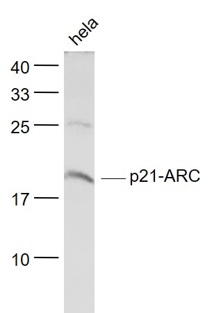 Lane 1: Hela cell lysates probed with p21-ARC Polyclonal Antibody, Unconjugated (bs-17589R) at 1:1000 dilution and 4˚C overnight incubation. Followed by conjugated secondary antibody incubation at 1:20000 for 60 min at 37˚C. Lane 1: Hela cell lysates probed with p21-ARC Polyclonal Antibody, Unconjugated (bs-17589R) at 1:1000 dilution and 4˚C overnight incubation. Followed by conjugated secondary antibody incubation at 1:20000 for 60 min at 37˚C.