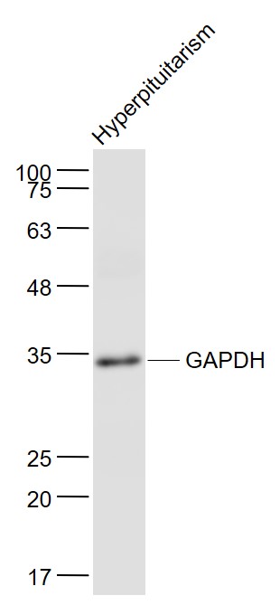 Hyperpituitarism lysates probed with GAPDH (4F8) Monoclonal Antibody, Unconjugated (bsm-33033M) at 1:1000 dilution and 4˚C overnight incubation. Followed by conjugated secondary antibody incubation at 1:20000 for 60 min at 37˚C.