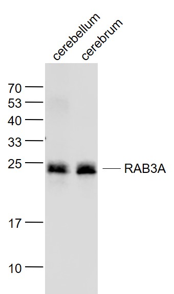 Lane 1: Mouse Cerebrum lysates; Lane 2: Mouse Cerebellum lysates probed with RAB3A (5B7) Monoclonal Antibody, Unconjugated (bsm-51311M) at 1:1000 dilution and 4˚C overnight incubation. Followed by conjugated secondary antibody incubation at 1:20000 for 60 min at 37˚C.