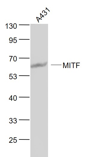 Lane 1: A431 cell lysates probed with MITF (M2A1) Monoclona Antibody, Unconjugated (bsm-51339M) at 1:1000 dilution and 4˚C overnight incubation. Followed by conjugated secondary antibody incubation at 1:20000 for 60 min at 37˚C.