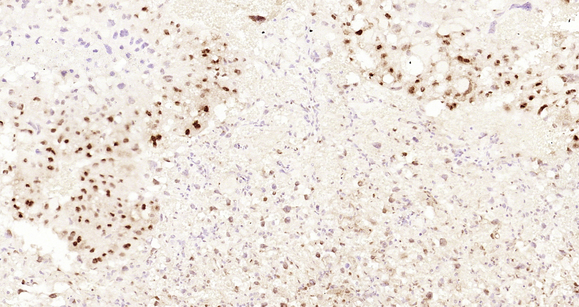 Paraformaldehyde-fixed and paraffin-embedded Mouse placenta tissue incubated with Cyclin E1 (4H7) Monoclonal Antibody (bsm-52048R) at 1:200, overnight at 4\u00b0C, followed by a conjugated secondary antibody and DAB staining. Counterstained with hematoxylin.