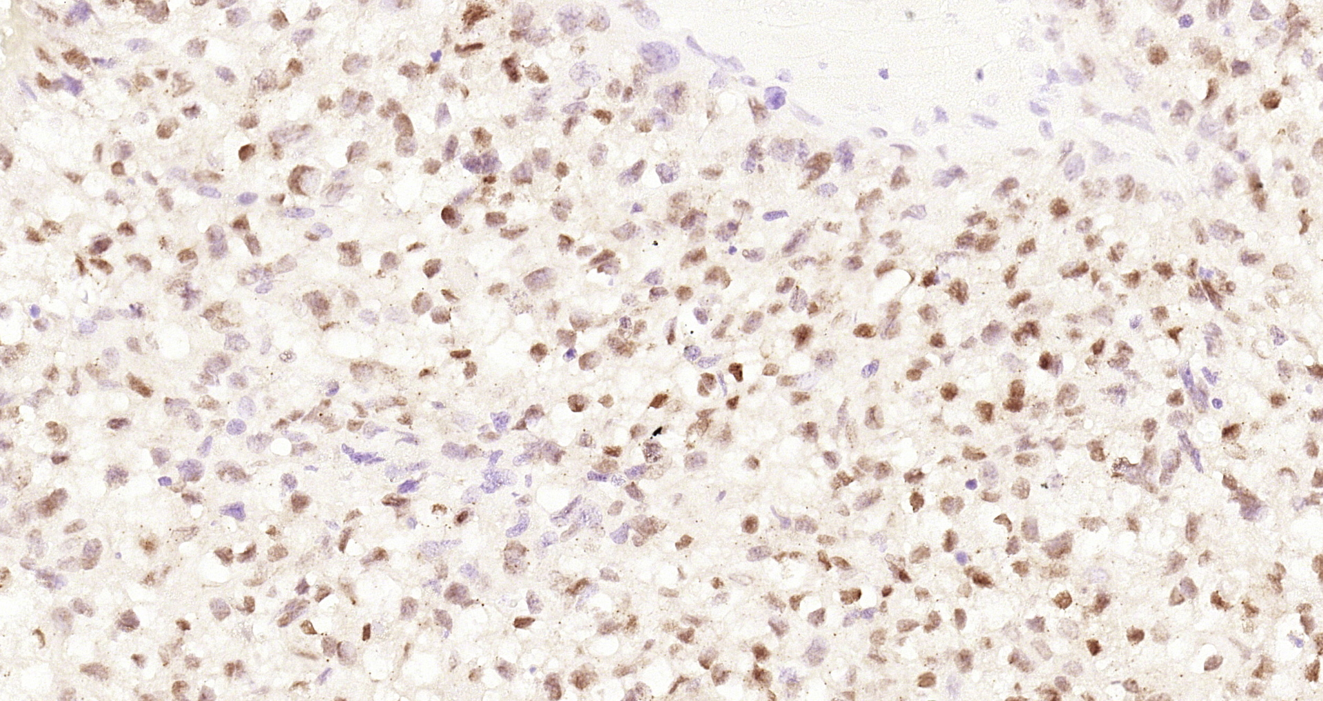 Paraformaldehyde-fixed and paraffin-embedded Mouse placenta tissue incubated with Cyclin E1 (4H7) Monoclonal Antibody (bsm-52048R) at 1:200, overnight at 4\u00b0C, followed by a conjugated secondary antibody and DAB staining. Counterstained with hematoxylin.