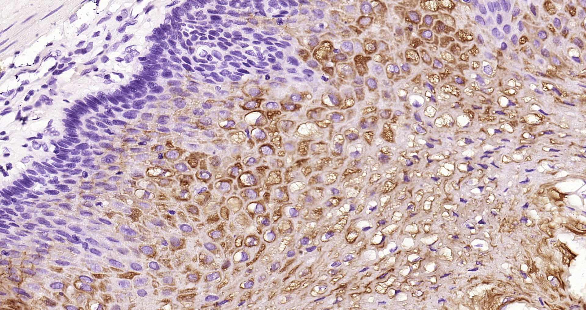 Paraformaldehyde-fixed and paraffin-embedded Human esophagus tissue incubated with Cytokeratin 2e (2F7) Monoclonal Antibody (bsm-52061R) at 1:200, overnight at 4\u00b0C, followed by a conjugated secondary antibody and DAB staining. Counterstained with hematoxylin.