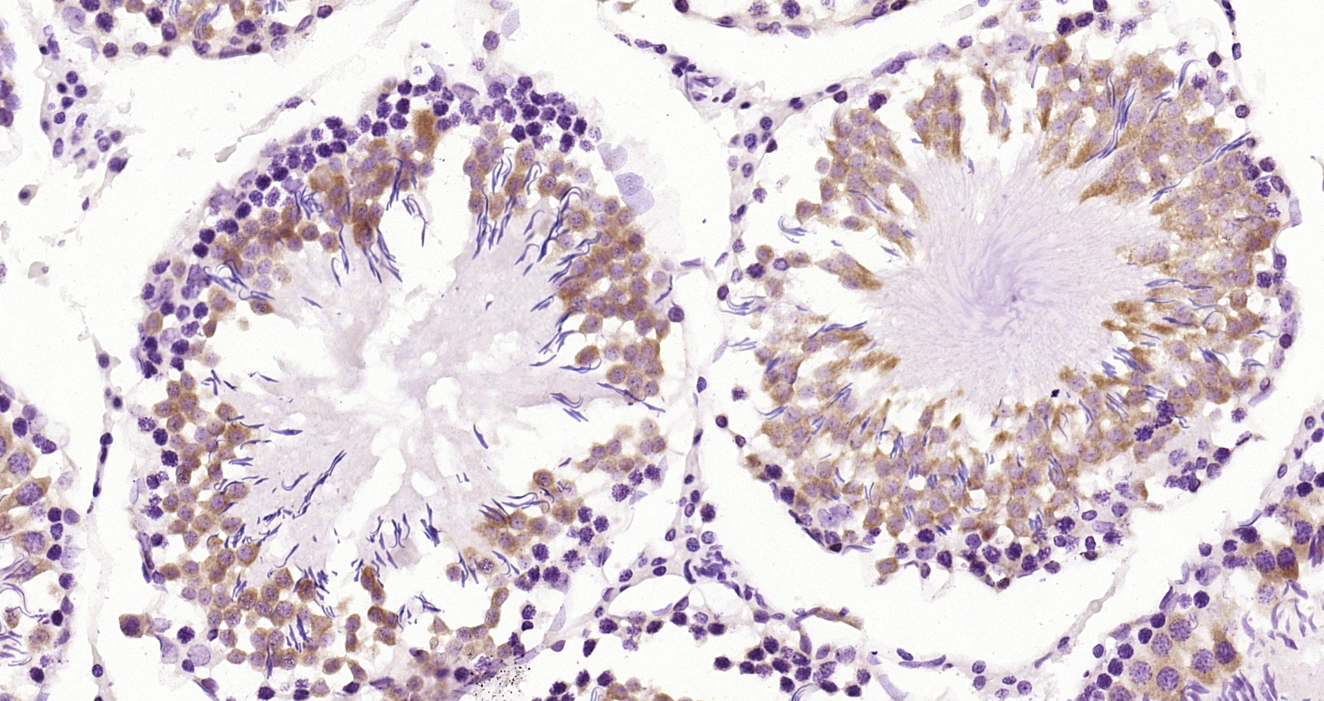 Paraformaldehyde-fixed and paraffin-embedded Rat testis tissue incubated with ERK5 (8D8) Monoclonal Antibody (bsm-52069R) at 1:200, overnight at 4\u00b0C, followed by a conjugated secondary antibody and DAB staining. Counterstained with hematoxylin.