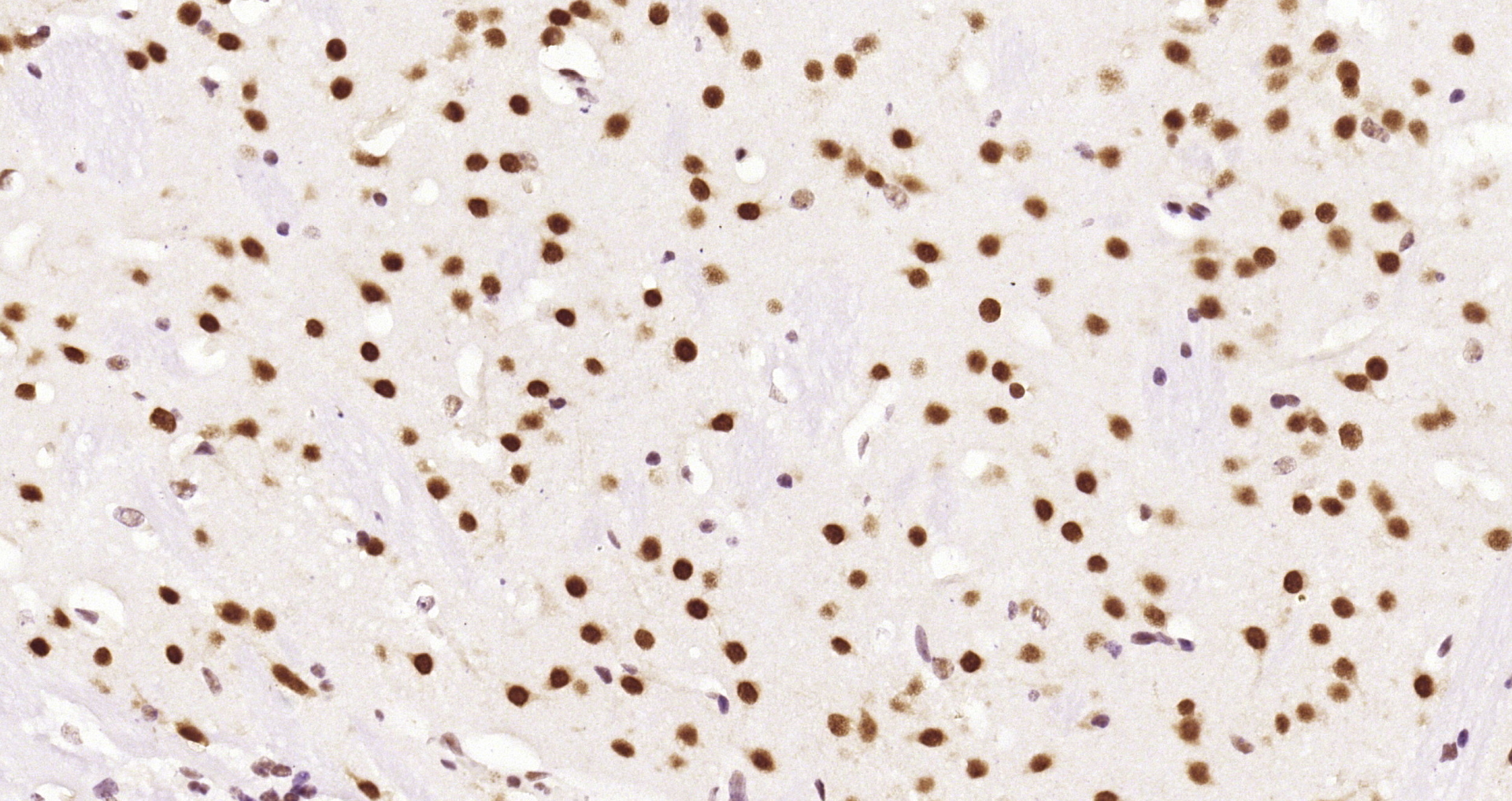 Paraformaldehyde-fixed and paraffin-embedded Mouse brain tissue incubated with HDAC2 (3B7) Monoclonal Antibody (bsm-52082R) at 1:200, overnight at 4\u00b0C, followed by a conjugated secondary antibody and DAB staining. Counterstained with hematoxylin.