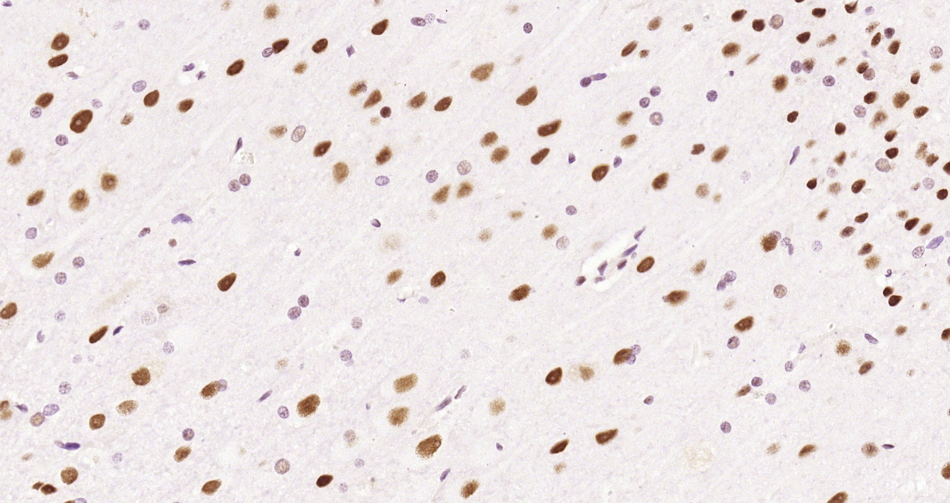 Paraformaldehyde-fixed and paraffin-embedded Rat brain tissue incubated with HDAC2 (3B7) Monoclonal Antibody (bsm-52082R) at 1:200, overnight at 4°C, followed by a conjugated secondary antibody and DAB staining. Counterstained with hematoxylin.