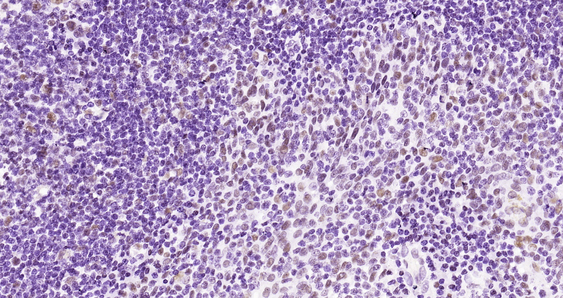Paraformaldehyde-fixed and paraffin-embedded Human tonsil tissue incubated with HDAC2 (3B7) Monoclonal Antibody (bsm-52082R) at 1:200, overnight at 4\u00b0C, followed by a conjugated secondary antibody and DAB staining. Counterstained with hematoxylin.