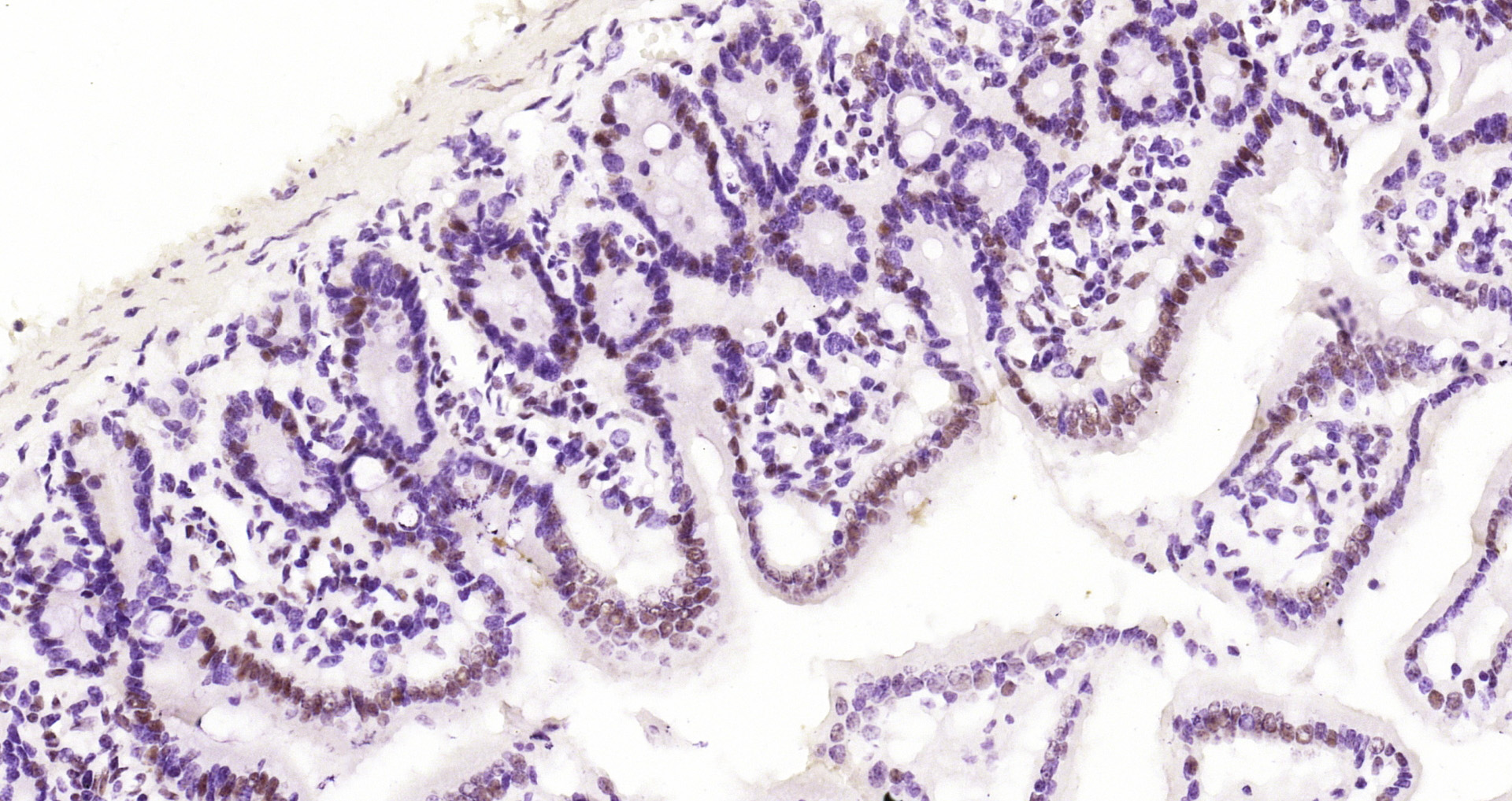 Paraformaldehyde-fixed and paraffin-embedded Mouse intestine tissue incubated with HDAC2 (3B7) Monoclonal Antibody (bsm-52082R) at 1:200, overnight at 4\u00b0C, followed by a conjugated secondary antibody and DAB staining. Counterstained with hematoxylin.