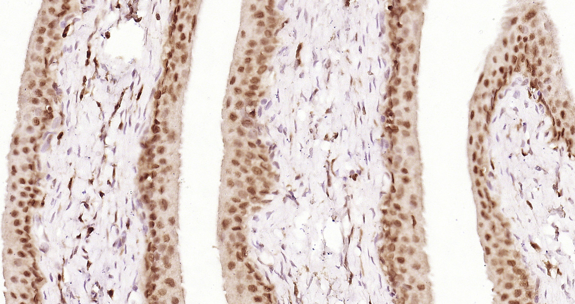 Paraformaldehyde-fixed and paraffin-embedded Rat bladder tissue incubated with MSK1 (Ser376) (11A1) Monoclonal Antibody (bsm-52123R) at 1:200, overnight at 4°C, followed by a conjugated secondary antibody and DAB staining. Counterstained with hematoxylin.